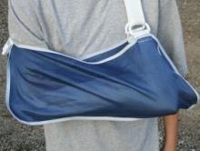 Bone Fractures Bone Fractures
